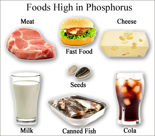 Calcium Restricted Diet Foods